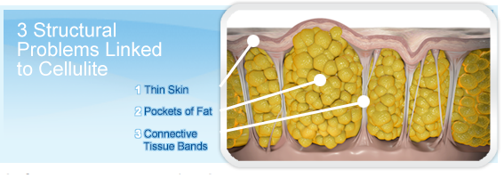 Cellulaze 3 problems